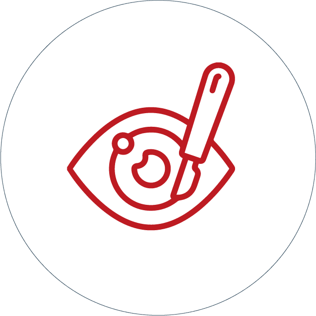 cirugia-ojos