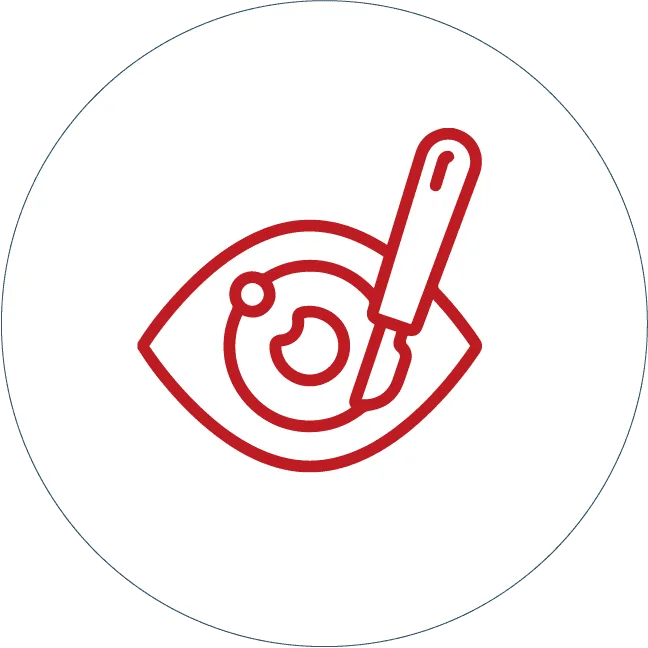cirugia-ojos