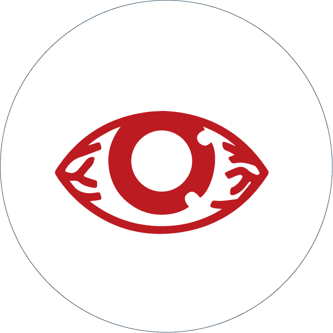 cirugia_cataratas